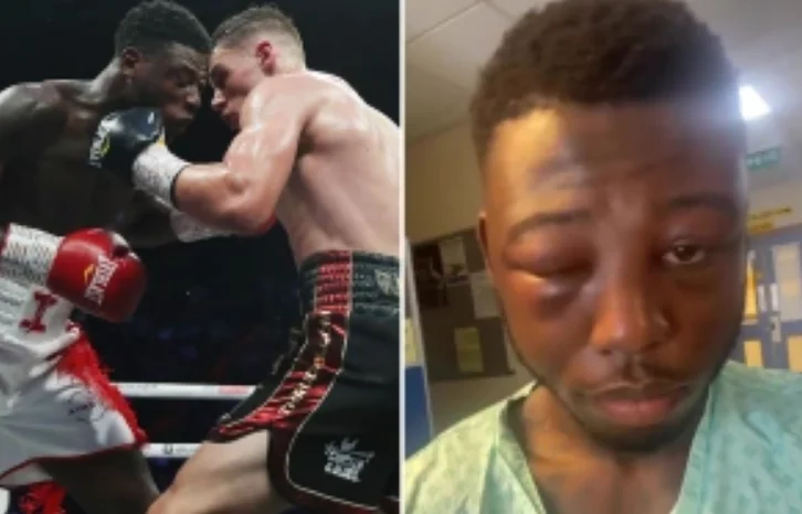 Boxer souffre beaucoup. Il publie des photos de l'hôpital avec un œil noir.