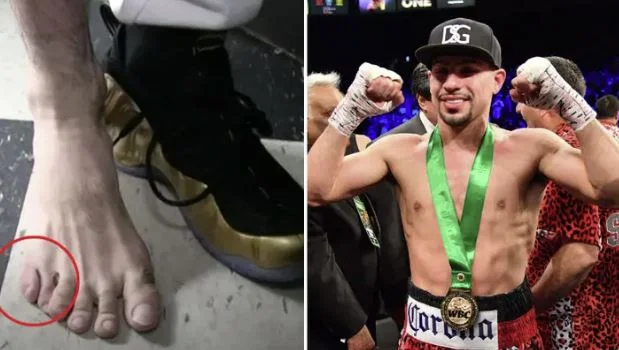 The former champion of the world in boxing has eleven fingers: Give me an advantage in the ring