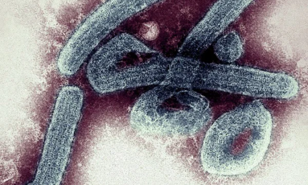 Il virus mortale “