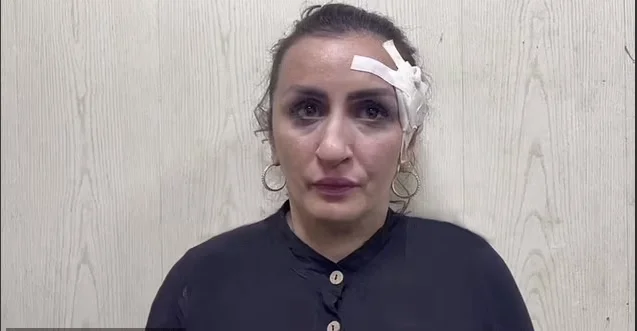 La madre rusa es arrestada: había vendido a su bebé para operar su nariz