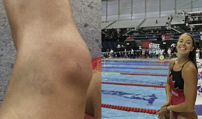 La nageuse canadienne dit avoir été droguée au Championnat du monde de Nott : Quand je me suis réveillée, mon corps était complètement noir.