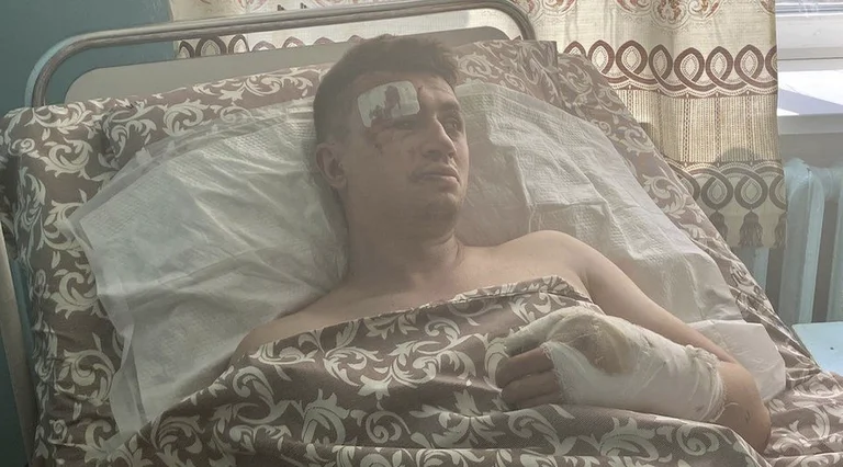 Confession of survivors by the attack on the mall in Ukraine: I didn't think they would attack such a place.