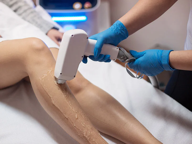 What are the side effects of removing laser hairs?