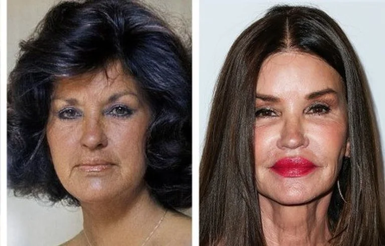 How would these ten celebrities look today if they hadn't had any cosmetics!