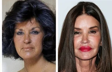 How would these ten celebrities look today if they hadn't had any cosmetics!