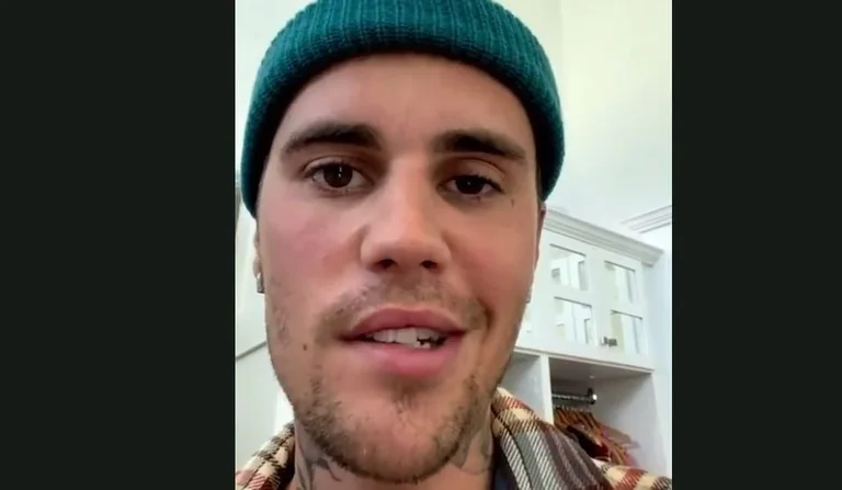Qu'est-ce que le syndrome de Ramsay Hunt souffrant de Justin Bieber