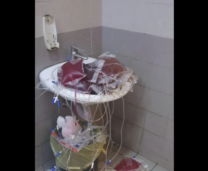E tmerrshme: Nuk është deponi bërlloku por “WC”-ja e QKUK-së, pamje që të gërrdisin