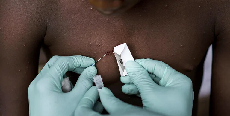 Russia says monkey smallpox originated in the US-controlled laboratory in Nigeria