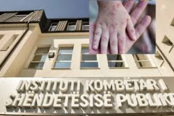 Monkey line: Still not infected in Kosovo, but IKKPK starts preparations
