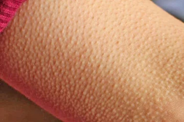 Senti la febbre nel tuo corpo? Considerate cosa mostrano sulla vostra salute e quando dovreste essere preoccupati