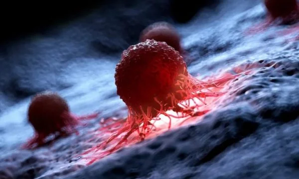 Une nouvelle enquête de Yale identifie les causes du cancer