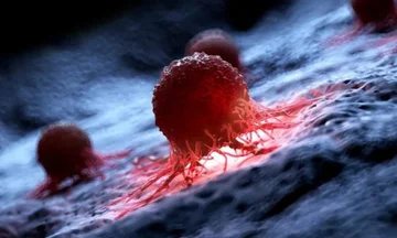Nuovo sondaggio di Yale identifica le cause del cancro