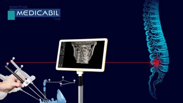 La chirurgia endoscopica del Pilastro Curioscolare