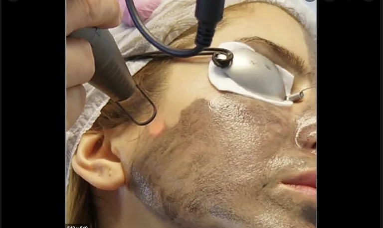 L'État n'a pas de supervision pour l'entreprise botox de gauche