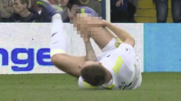 Infortunio maggiore sul Premierliga Leeds Protector ottiene il ginocchio dal paese in un incidente con Grealish