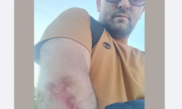 L'ancien conseiller Kurt, Shkelzen Gashi, est attaqué par des chiens errants
