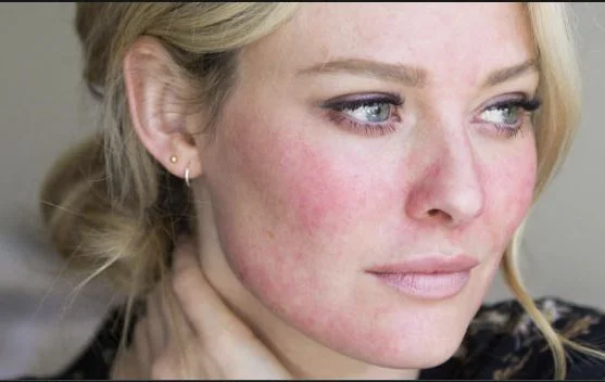 Ce sont les causes les plus courantes de coloration