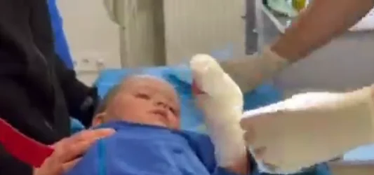Missile attacks in Ukraine: Doctors are forced to cut off their finger from three-year-olds