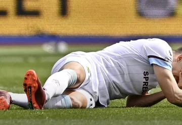 Neue und sehr schwere Bilder: Schauen Sie sich einige Bilder von, wie der Burnley Spieler das Bein brach