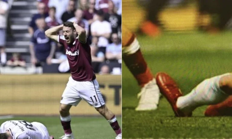 Echter Horror. Burnleys Spieler bricht sein Bein, sieht sehr schwer aus.