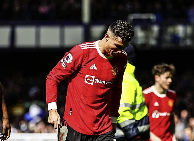 You saw Ronaldo's injury on his feet, walked hard, blood flowed