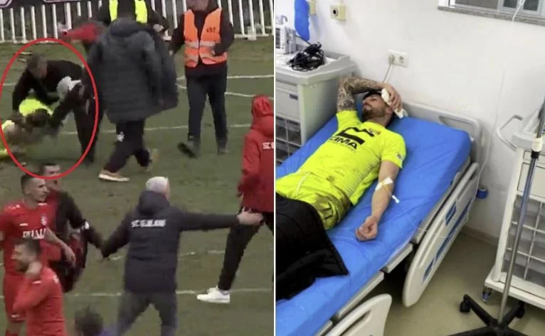 He was physically assaulted by Gnjilan's fans, his first response is Steve Frasher.