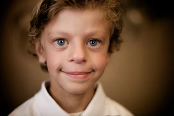 What is a rare Williams syndrome and why it is known as a friendly syndrome