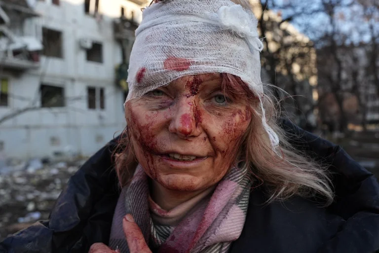 Das Bild der Frau, die die Welt traurig gemacht hat: Ich bin glücklich, lebendig zu sein, ich werde für die Ukraine alles tun, was ich kann.