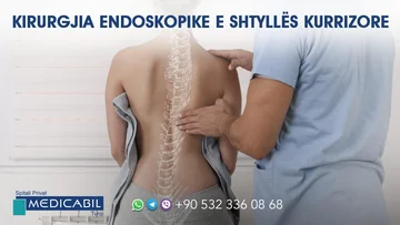 Die endoskopische Chirurgie der Kuriosksäule