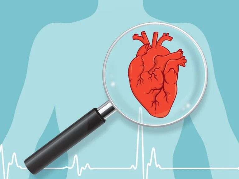 Nouveau facteur qui augmente le risque de maladies cardiaques
