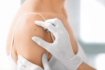 Hence, annual skin control is essential
