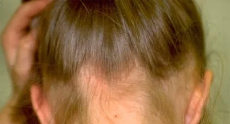 Mortai alla scuola di Komoran, i medici lamentano che non hanno medicine