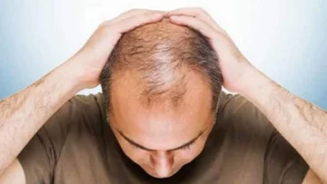 La perdita di capelli può essere un segno di grave malattia