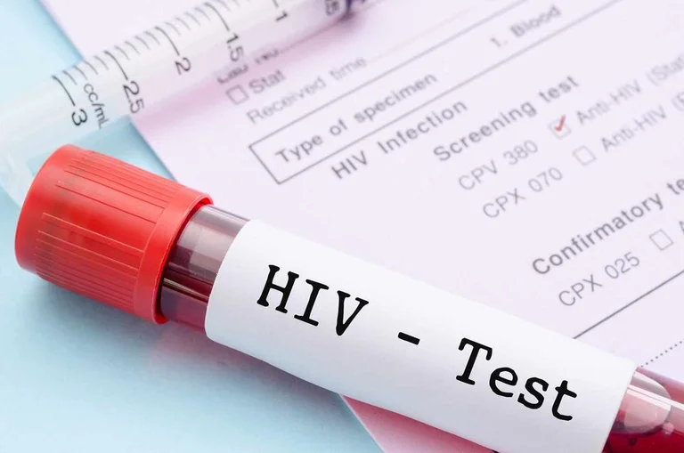Tetë raste të reja me HIV/AIDS në Kosovë gjatë vitit 2021