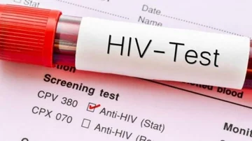 10 raste të reja me HIV në muajt e fundit, 2 viktima e 2 në spital, rritet testimi vullnetar