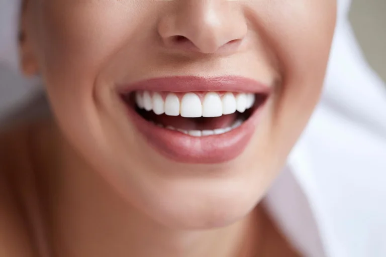 Se vuoi denti bianchi, evita questi alimenti