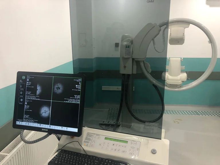 L'ospedale Ferizaj è prima dotato di mammografia