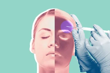 Does the botox treat chronic migraine?
