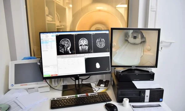 Radiology carried out about 7 thousand magnetic resonances, leaving radiation effects on the Cuddy-19