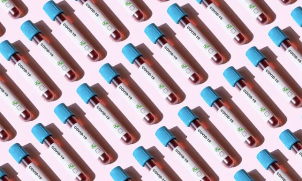 Soll ich einen Antikörpertest machen, um zu sehen, ob der Impfstoff wirkt? Antwort von Experten