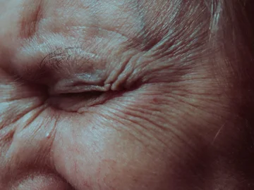 Some simple advice to prevent wrinkles now