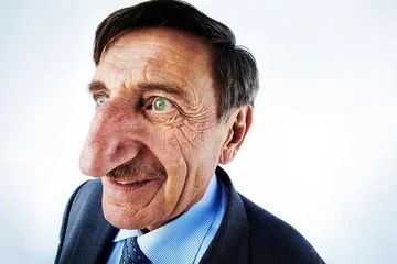 El hombre con la nariz más grande del mundo ( Foto)