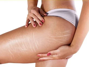 How to treat autumn stages, natural products for higher results
