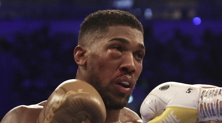 It was completely dominated by the Ukrainian opponent for 12 rounds: These are Joshua's words after his disappointing loss