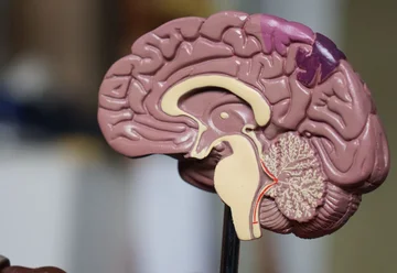 An unknown disease? The mysterious symptoms in the brain surprise doctors