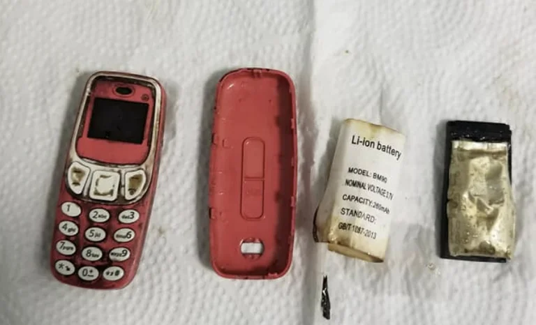 QKUK: 33 vjeçarit i nxirret telefoni nga stomaku