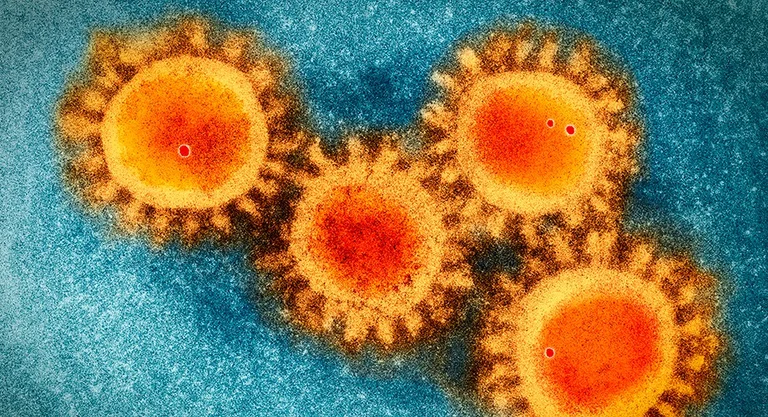 Quatre scénarios de développement du virus vivant