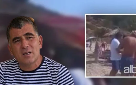 Shfaqet përsëri Kokëdhima: Sherr me turistët në plazh, ndërhyn Policia