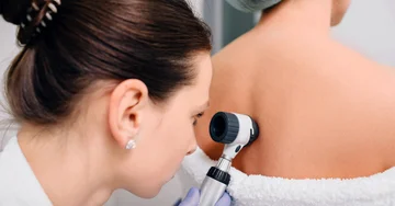 Why Annual Skin Control Essential