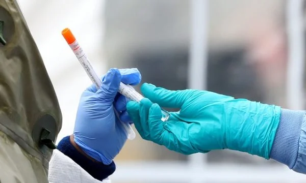 Qendrat mjekësore në Kosovë që kryejnë teste rapide për COVID-19, vatra të infeksionit